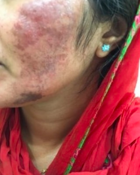 Semburan Aloe Vera Buatan Sendiri – Untuk Kulit Terbakar Semburan Aloe Vera Buatan Sendiri – Untuk Kulit Terbakar